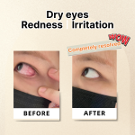 Reduce dry eyes, eye redness and irritation.